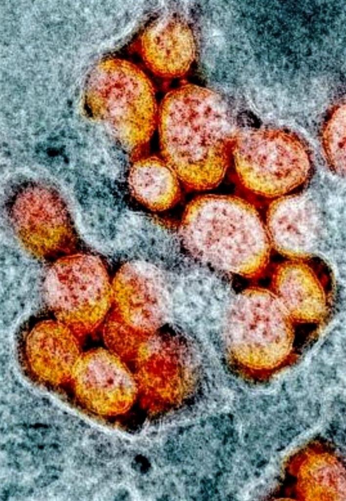photo of actual COVCID viruses